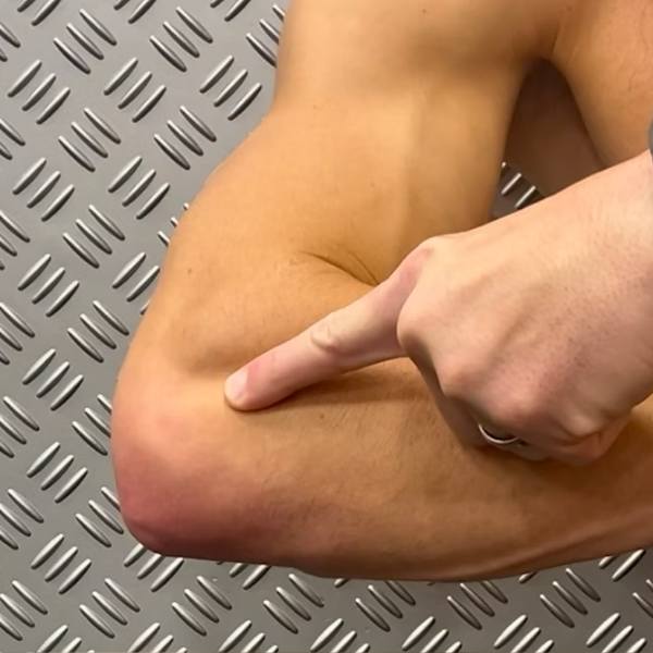 Elbow Pain, conditions we treat