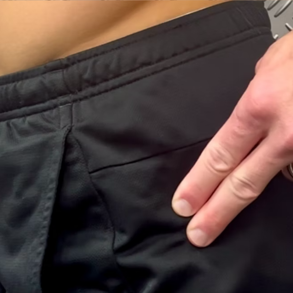 Hip Pain, conditions we treat