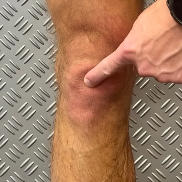 Knee Pain, conditions we treat